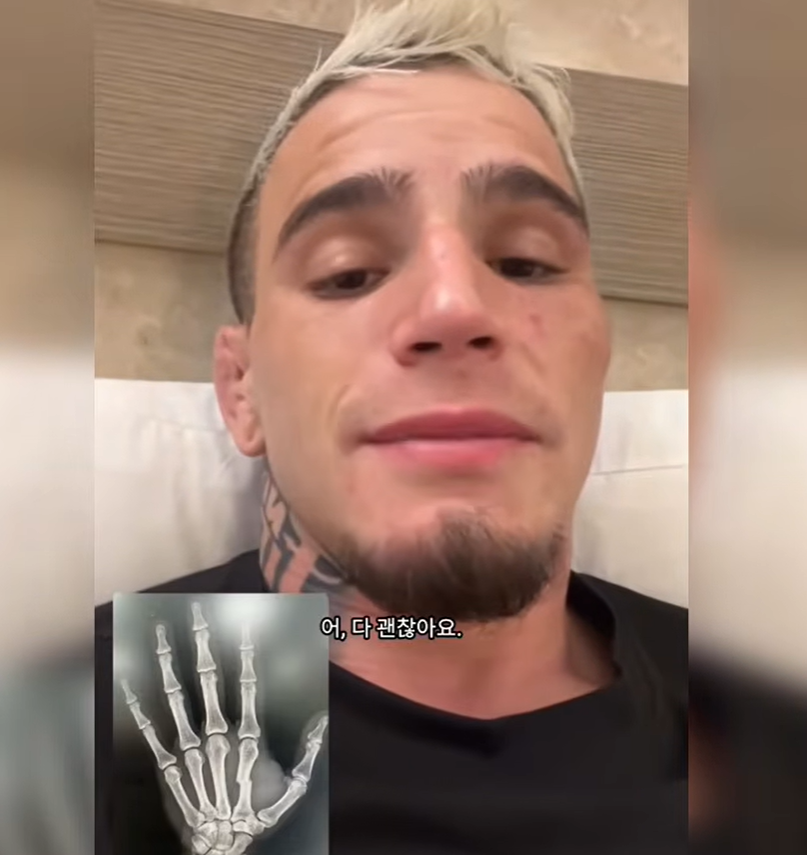 Felipe Pereira announces hand injury